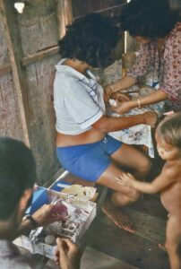 Técnica do INPA, retirando leite materno para a pesquisa de Lepra (hanseniase) no Bairro Coroados em Manaus, AM, 1981.